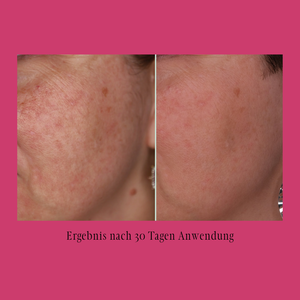 Master your Skin - einfach gesunde Haut