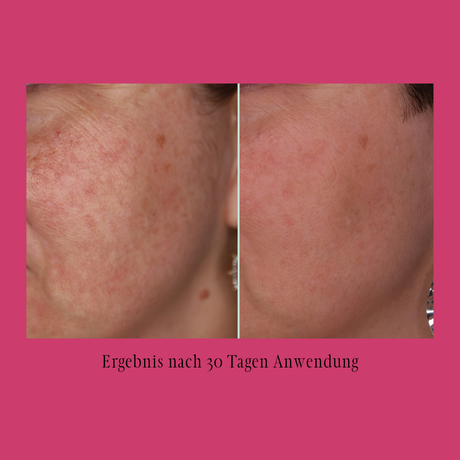 Master your Skin - endlich gesunde, glatte & ebenmäßige Haut